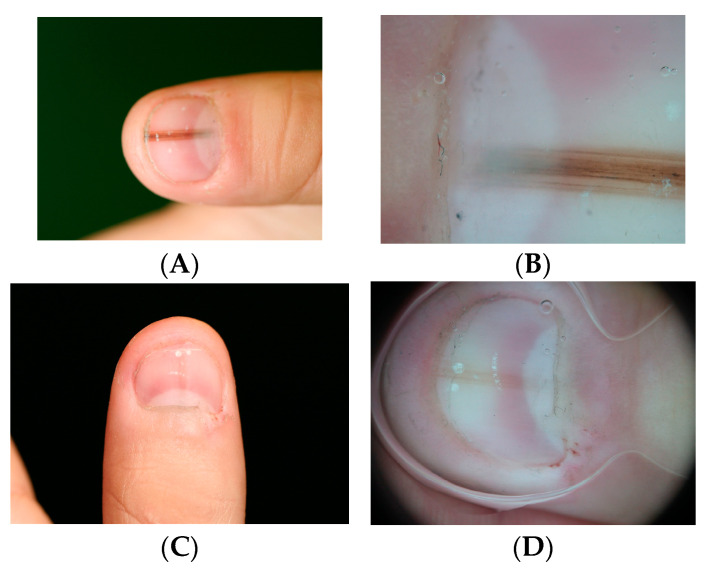 Figure 9