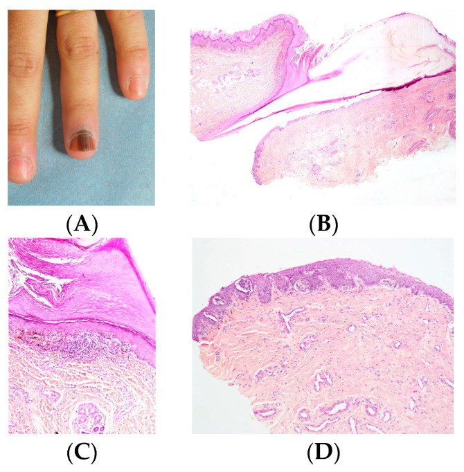 Figure 11