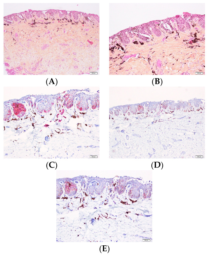 Figure 12