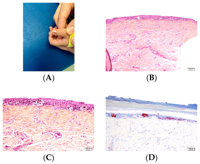 Figure 13