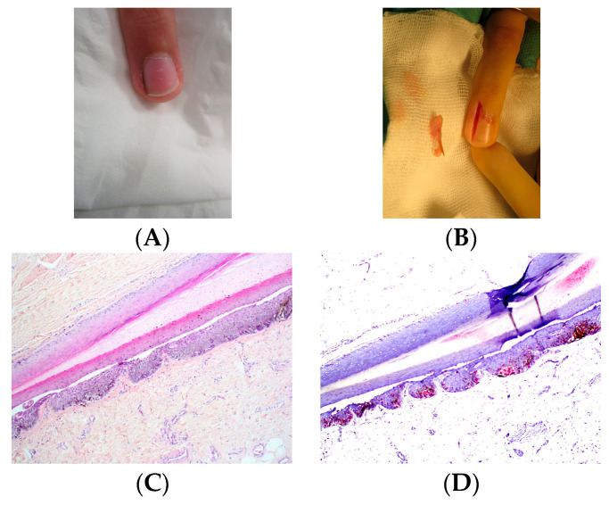 Figure 14