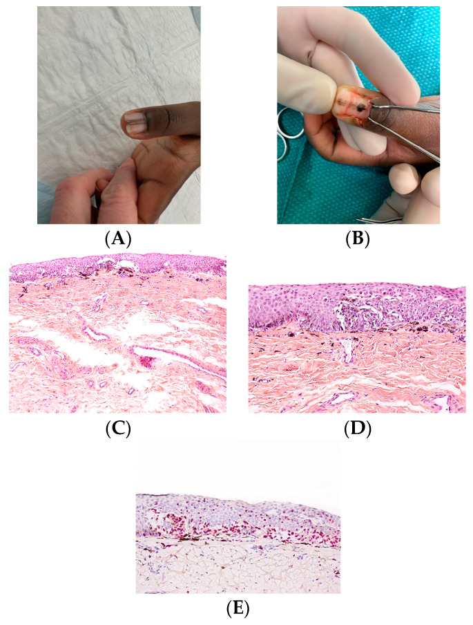 Figure 17