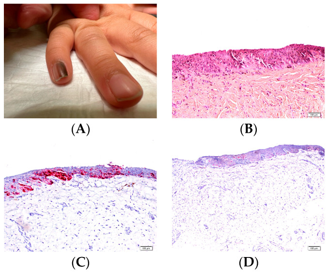 Figure 18