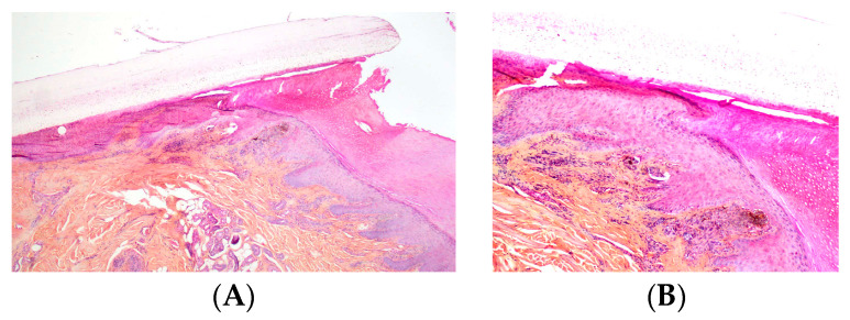 Figure 19