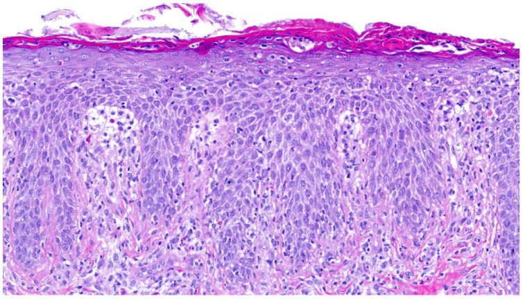 Figure 12