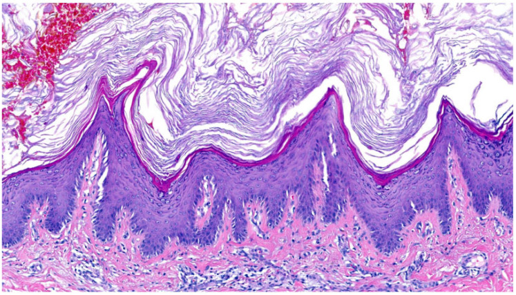 Figure 13