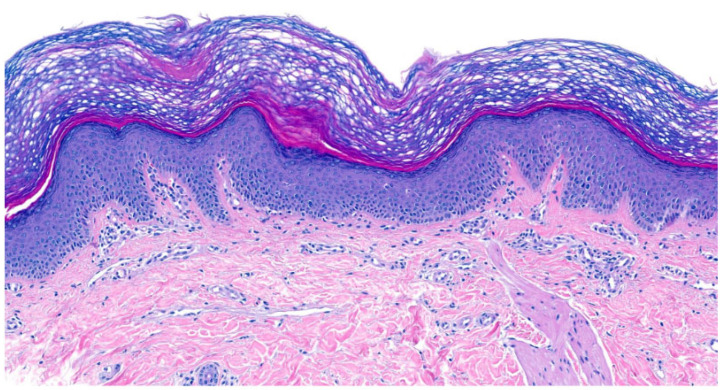 Figure 14
