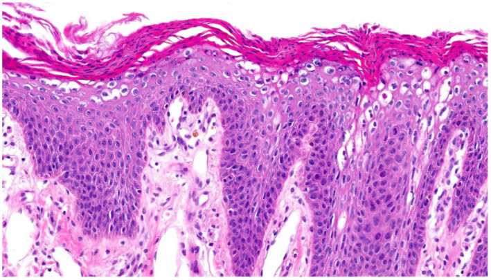 Figure 16