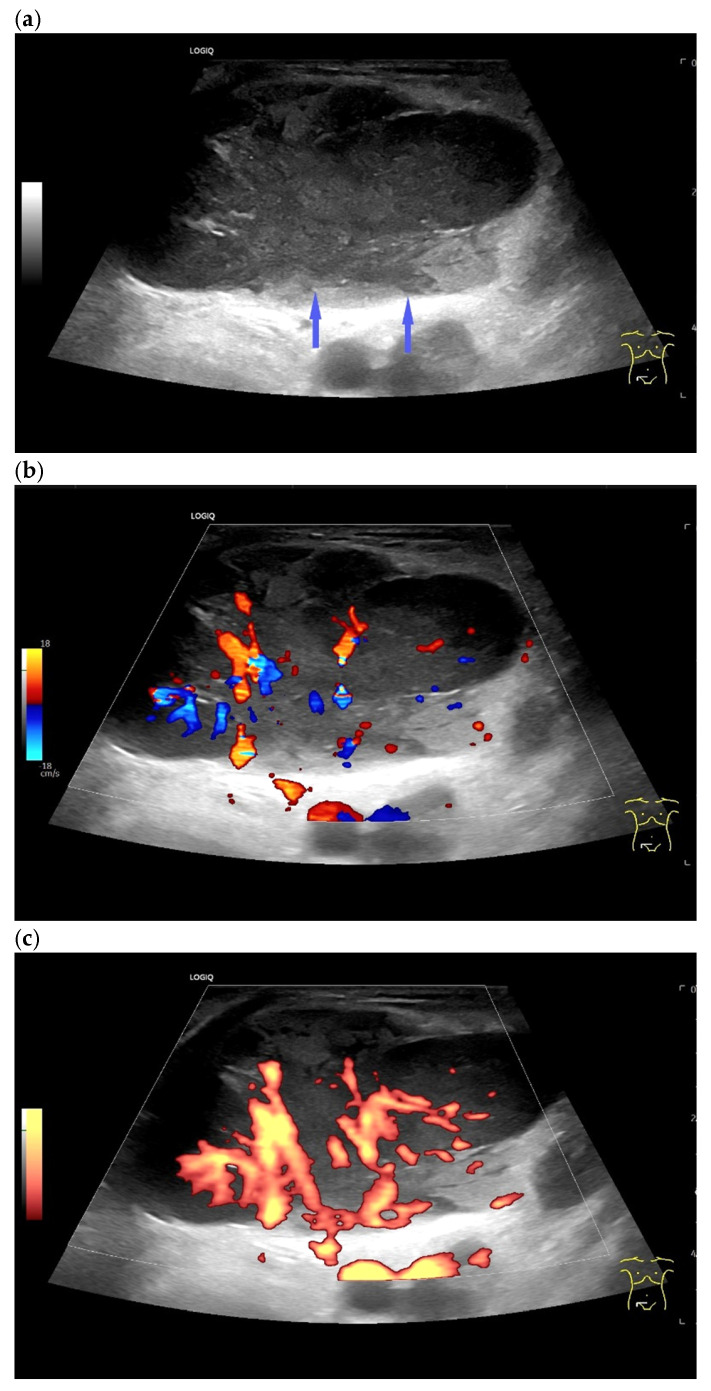 Figure 10