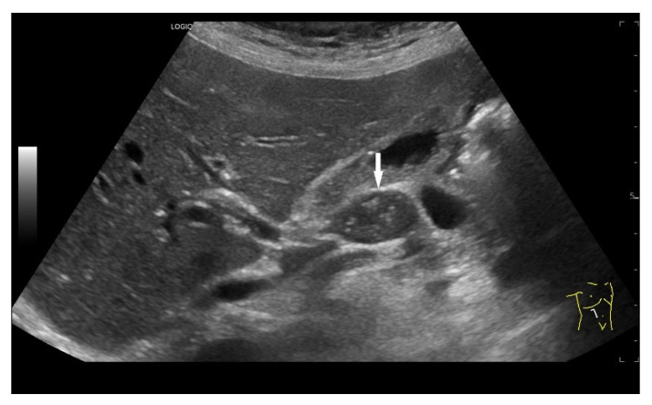 Figure 13