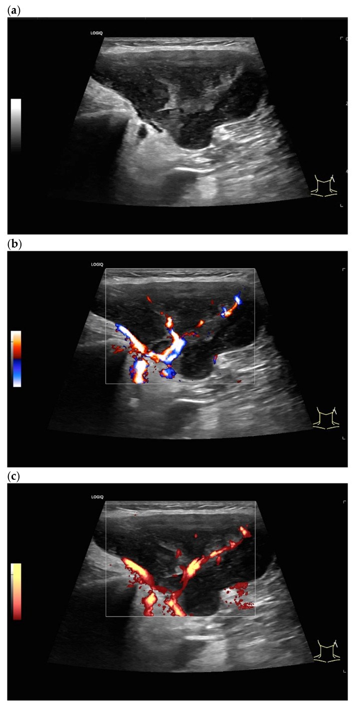 Figure 15