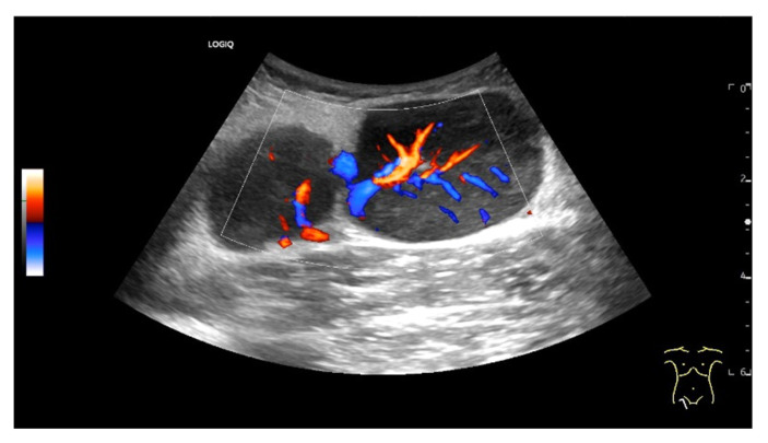 Figure 16