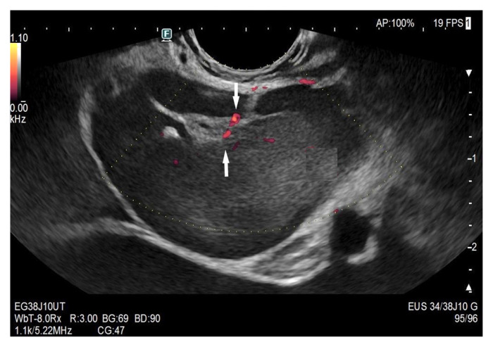 Figure 17