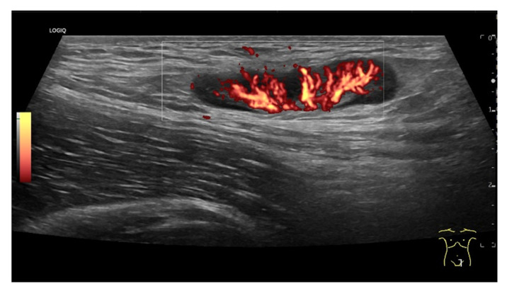 Figure 18