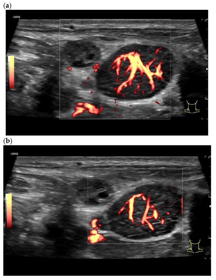 Figure 19