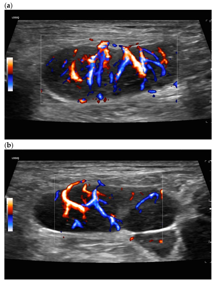 Figure 20