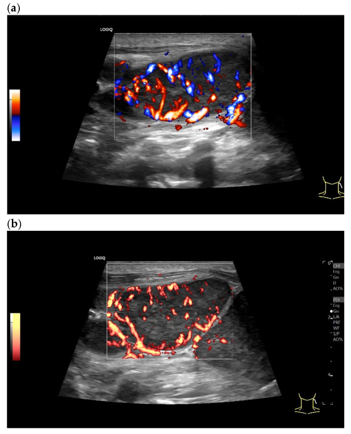 Figure 21