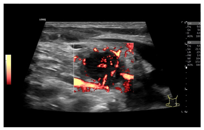 Figure 22