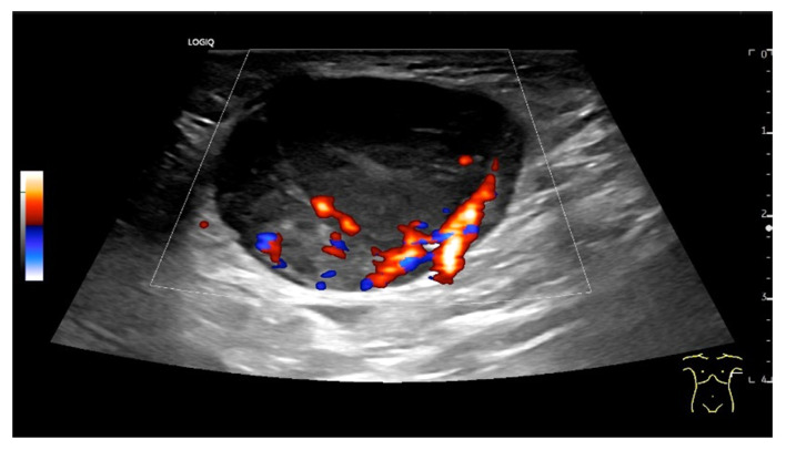 Figure 23