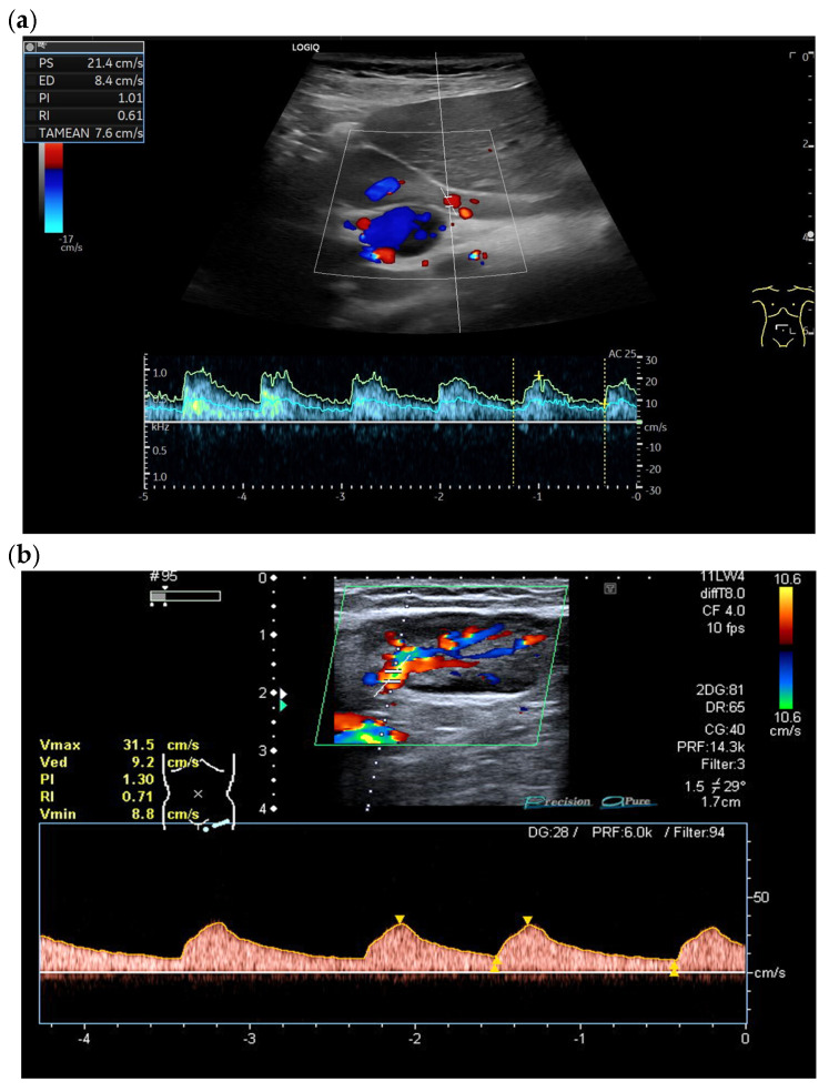 Figure 24