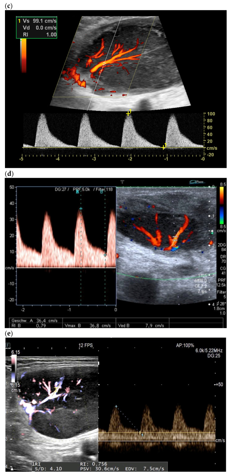 Figure 25