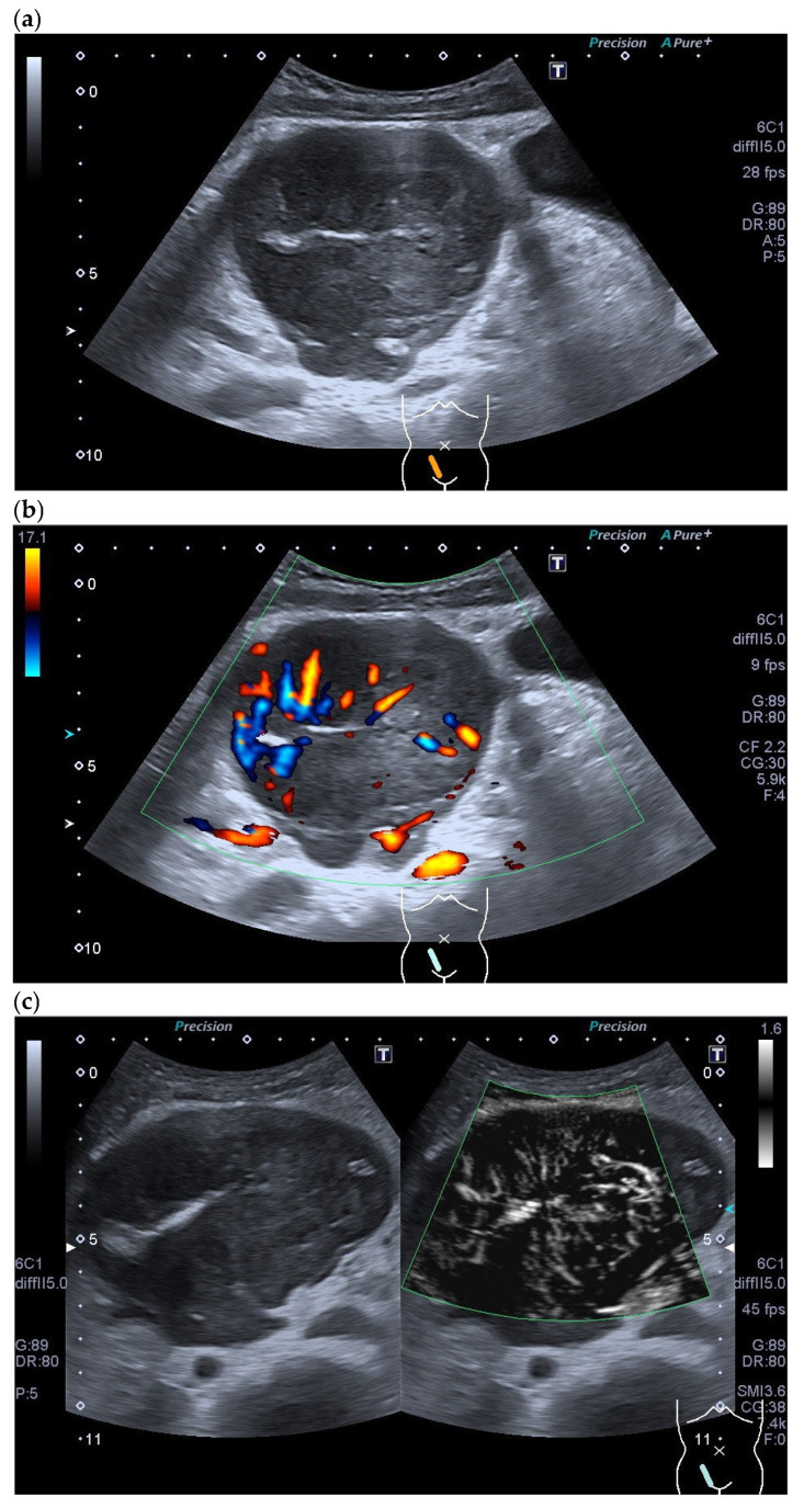 Figure 26