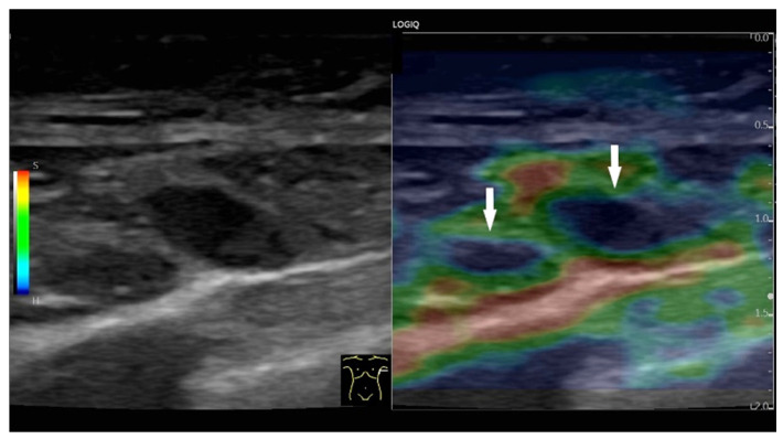 Figure 28