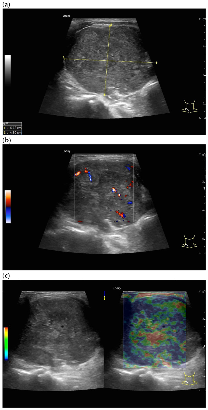 Figure 29