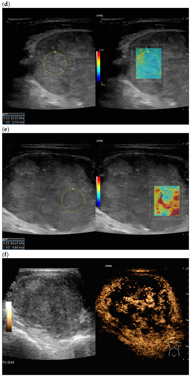 Figure 30