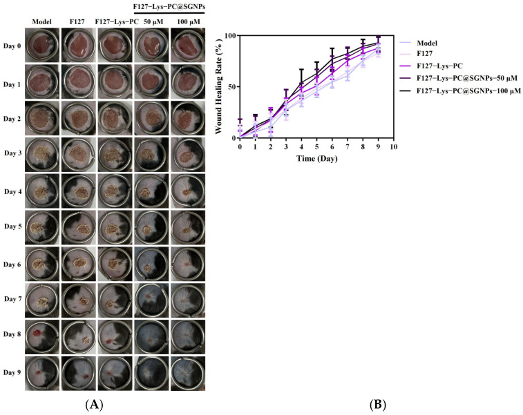 Figure 11
