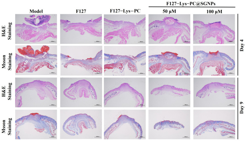 Figure 12