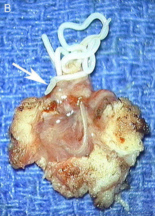Figure 14