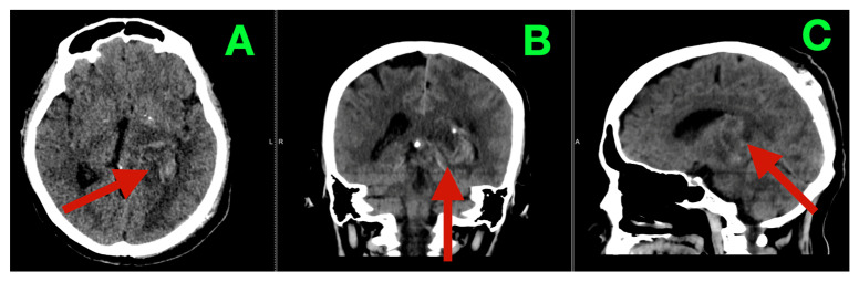 Figure 5