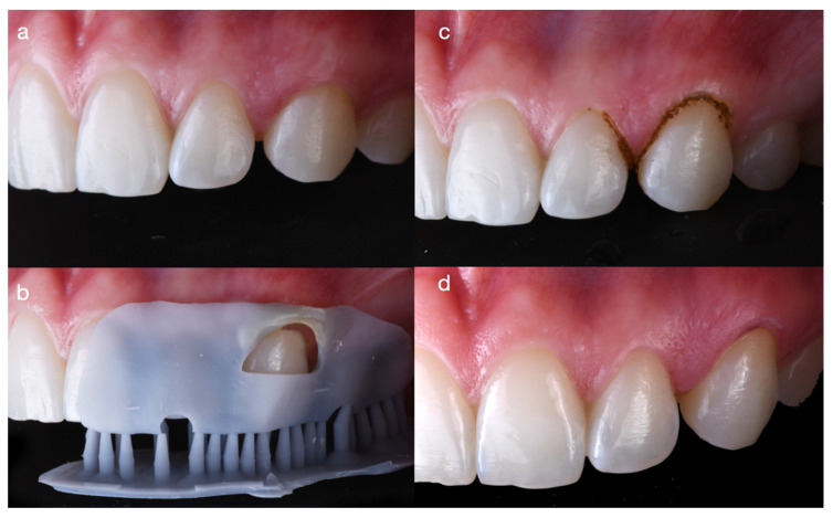 Figure 4