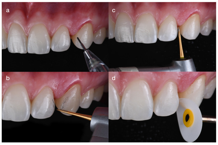 Figure 5