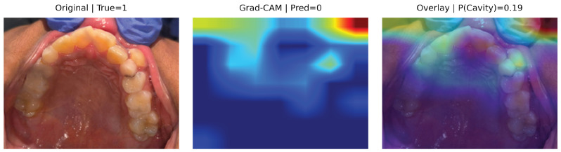 Figure 11