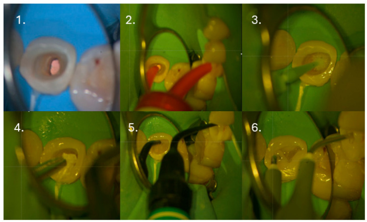 Figure 10