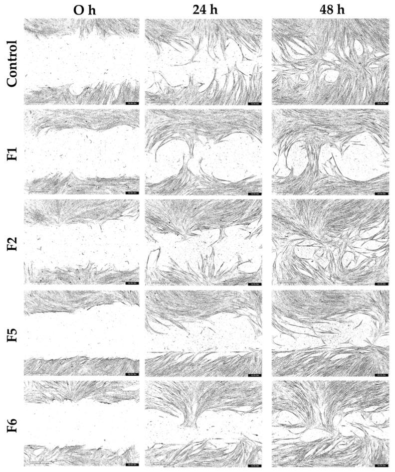 Figure 11