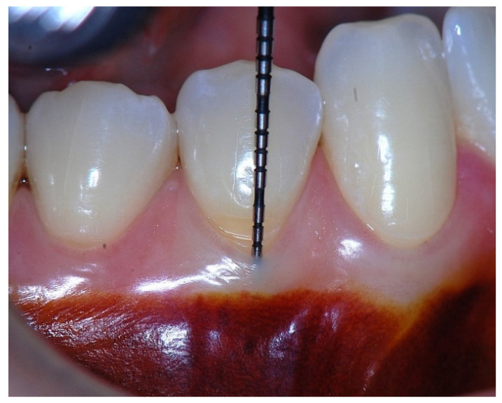 Figure 9