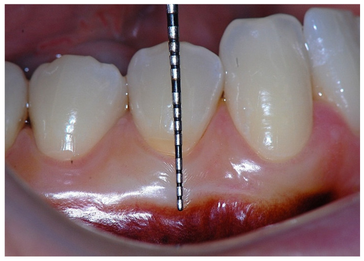 Figure 11