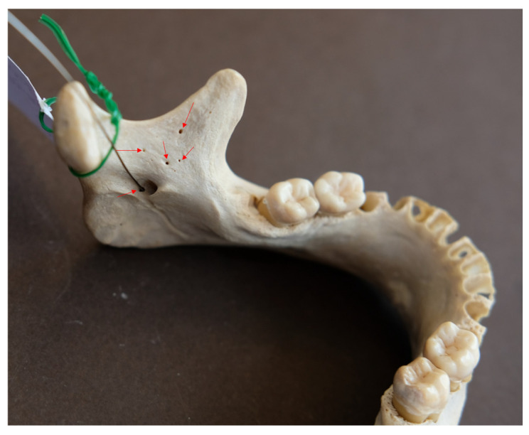 Figure 7