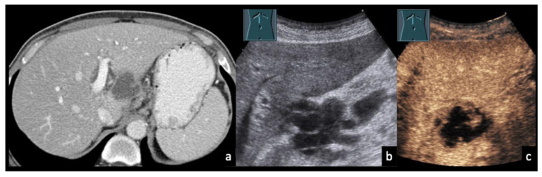 Figure 9