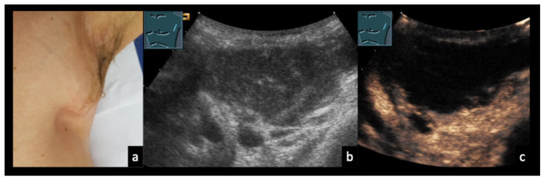 Figure 11