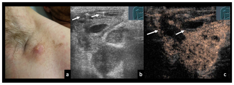 Figure 12