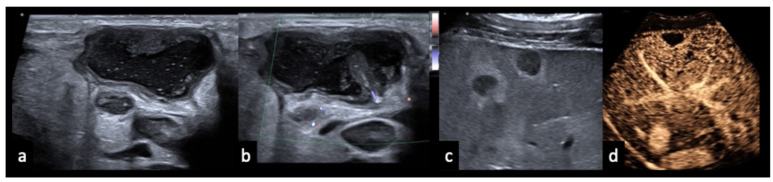 Figure 13