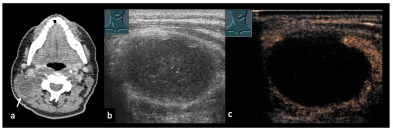 Figure 14