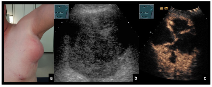 Figure 17