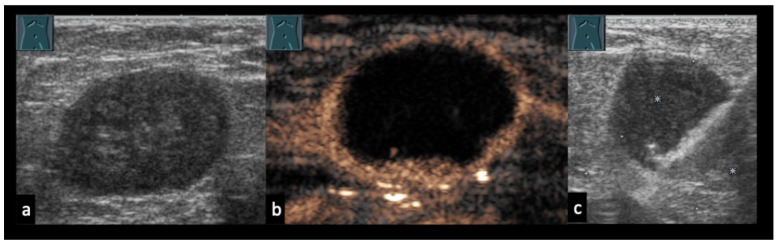 Figure 18