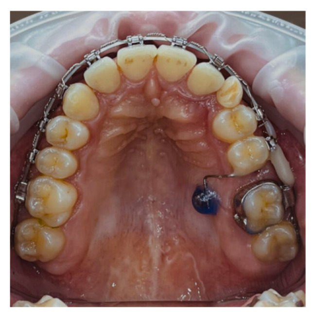 Figure 9