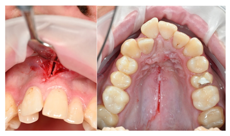 Figure 12